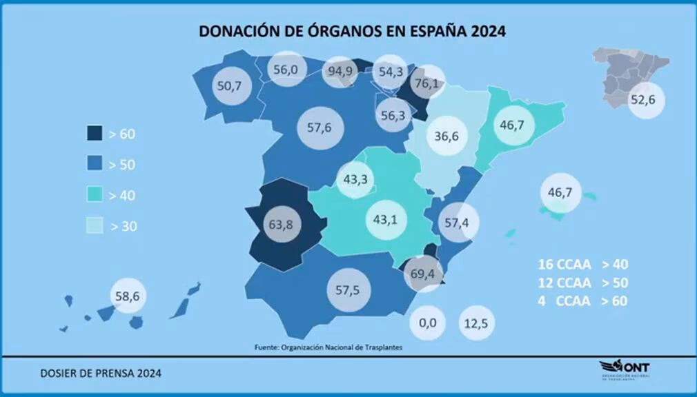 ¿Por qué la donación de órganos es tan alta en España?